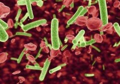 科普|致瀉大腸埃希氏菌是什么?